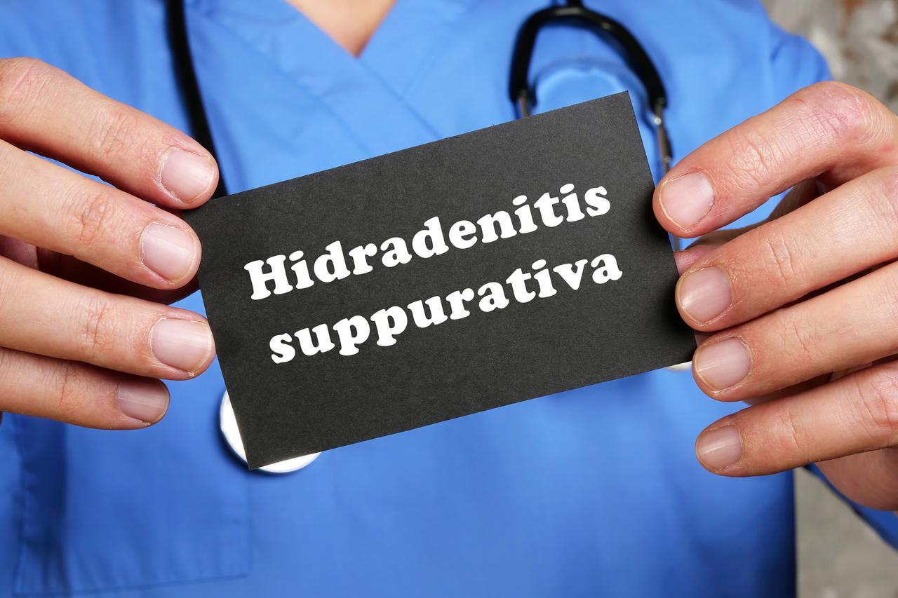 Hidradenitis suppurativa