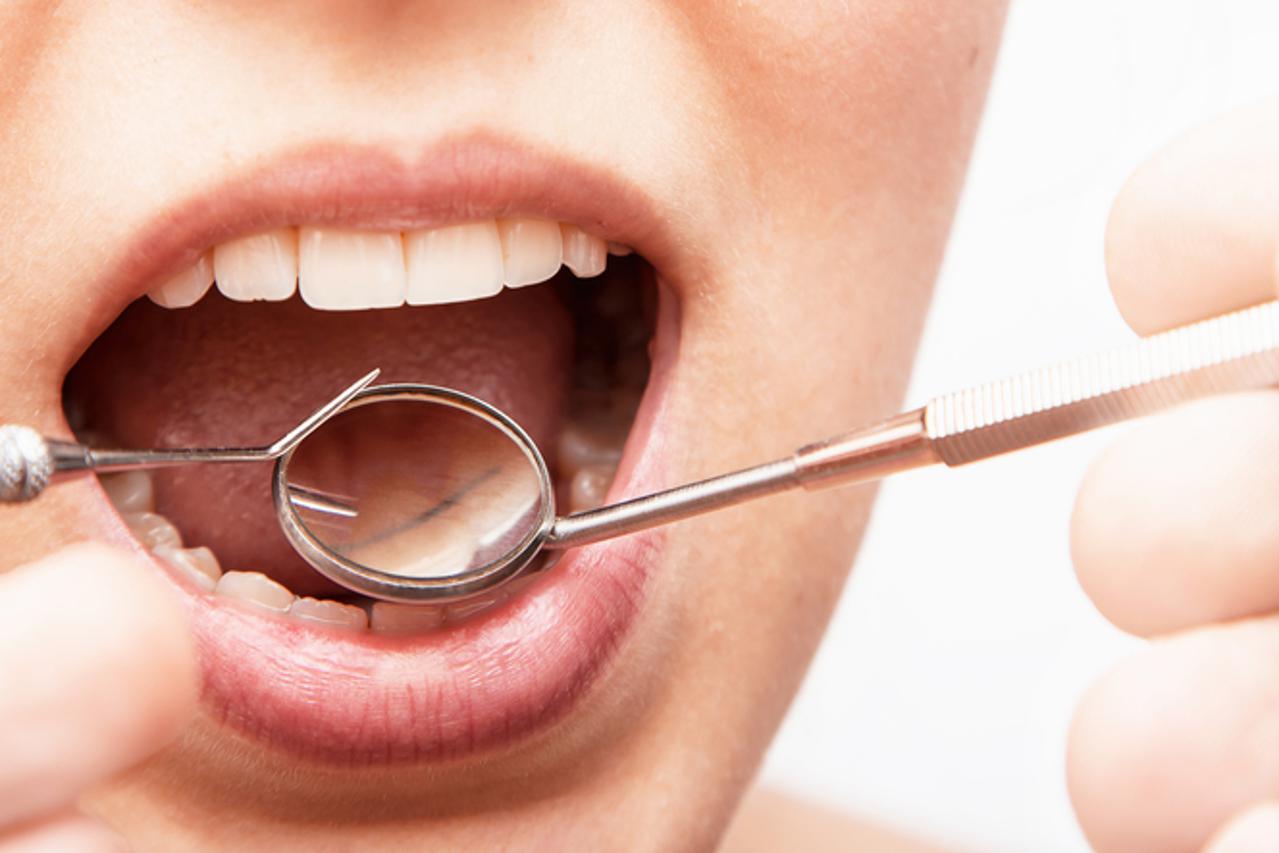 Važnost parodontne medicine