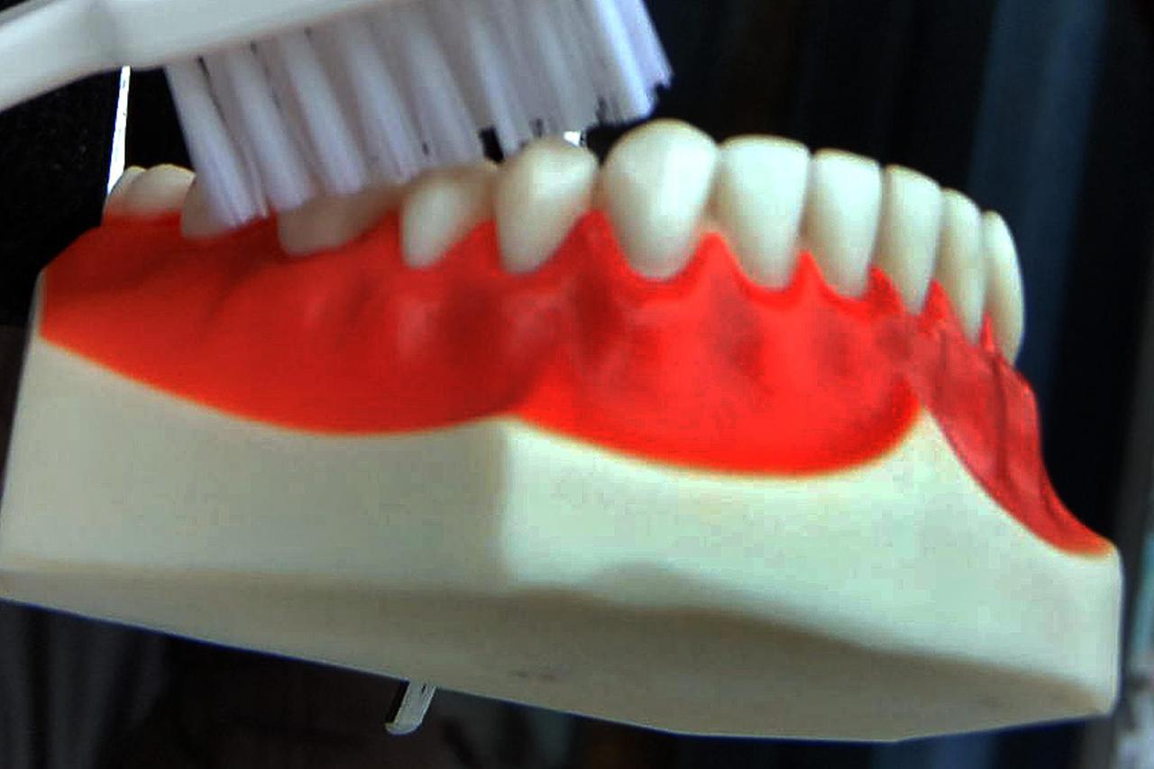 zubalo zubi