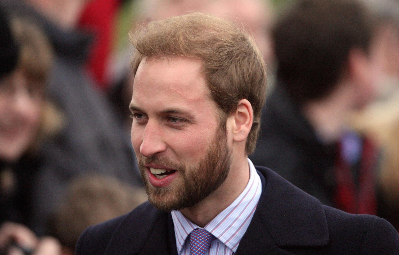 Nije tajna da princ William već godinama gubi kosu.
