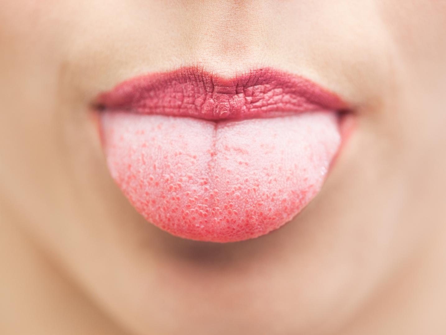– Katkada je jezik glavni krivac za loš zadah, ne zaboravite ga dobro očistiti jer se bakterije skupljaju na dnu jezika – zaključuje Ada.