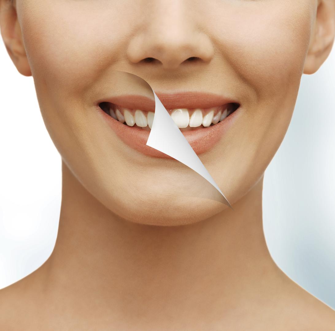 Na četkicu stavite malo paste za zube te umočite u sodu bikarbonu. Polako i detaljno trljajte zube barem dvije minute, te isperite vodom. Nakon toga operite zube samo pastom. Ovaj postupak ponavljajte dva puta mjesečno.