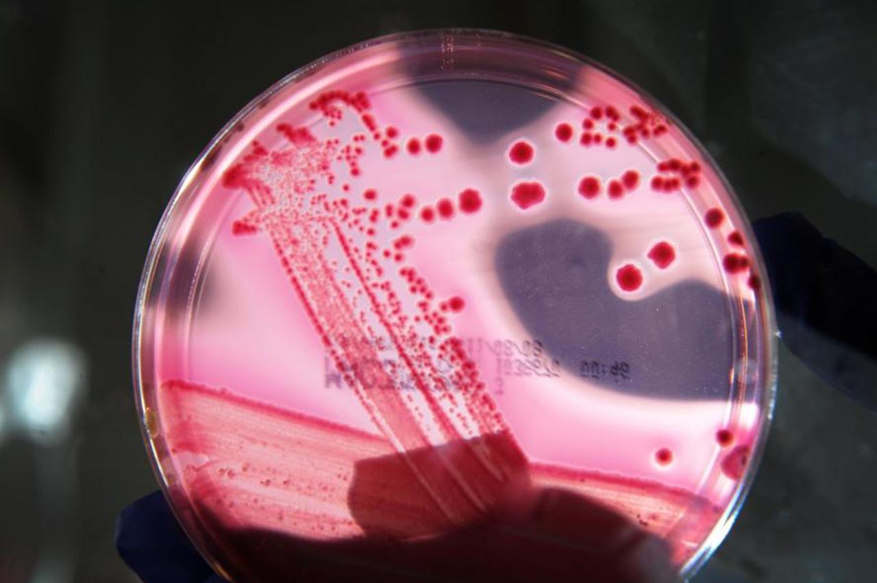 bakterija portal (1)