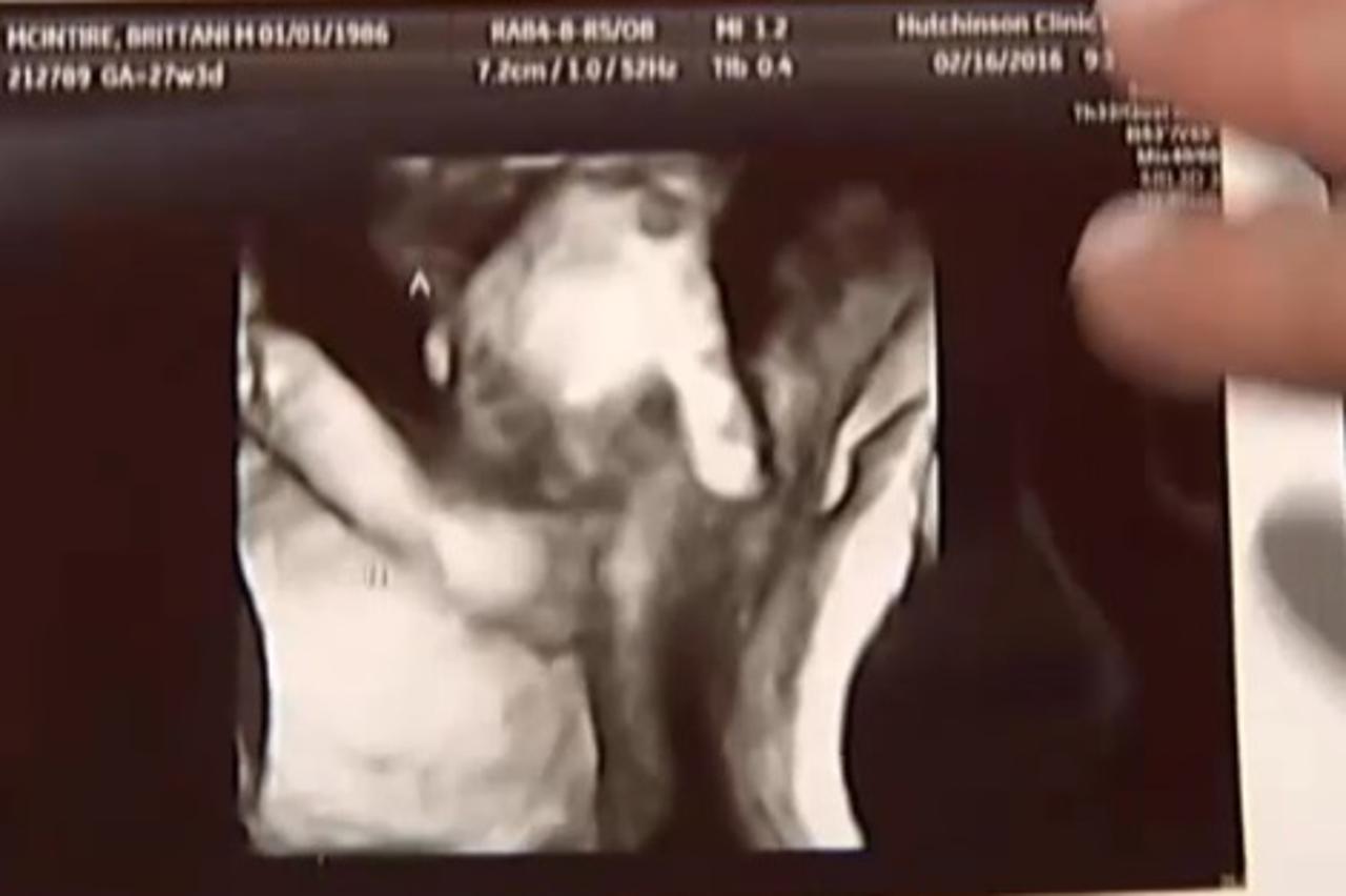 Bebe na ultrazvuku 