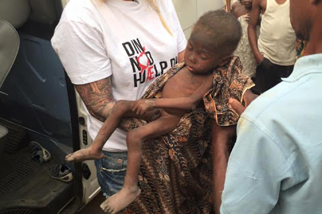 Izgladnjeli nigerijski dječak Hope